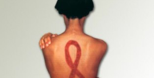 hiv-lesbians